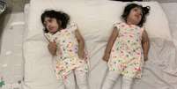 Safa e Marwa tiveram alta do hospital cinco meses após a cirurgia, mas continuaram morando em Londres por um tempo  Foto: BBC News Brasil