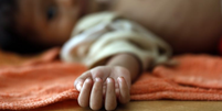 Criança desnutrida no Iêmen; estudo internacional prevê 6,7 milhões a mais de crianças desnutridas no mundo por causa da pandemia  Foto: EPA / BBC News Brasil