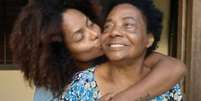 Adriana Bombom e a mãe, Enerstina, que morreu aos 75 anos vítima do novo coronavírus  Foto: Instagram/@adrianabombom / Estadão