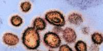 No último sábado, o Reino Unido anunciou a descoberta de uma nova variante do coronavírus mais infecciosa e "fora de controle", segundo o ministro da Saúde britânico Matt Hancock  Foto: EPA / BBC News Brasil