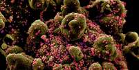 Imagem de célula infectada com coronavírus 
Instituto Nacional de Alergias e Doenças Infecciosas dos EUA/Divulgação via REUTERS  Foto: Reuters