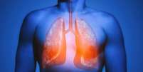 Covid-19 pode deixar problemas crônicos nos pulmões e outros órgãos, como a fibrose pulmonar  Foto: Getty Images / BBC News Brasil