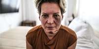 Joice Hasselmann é fotografada com hematomas no rosto em seu apartamento funcional em Brasília  Foto: Gabriela Biló / Estadão Conteúdo