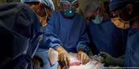 Órgão cumpriu as funções esperadas de um rim transplantado  Foto: DW / Deutsche Welle