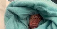 Bebê foi abandonado na lixeira de um avião  Foto: Reprodução | Redes Sociais