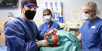 Médicos da Universidade de Maryland seguram coração de porco. Genes que causam rejeição em humanos foram inativados  Foto: DW / Deutsche Welle