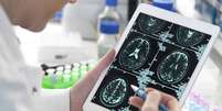Estudos científicos mostraram alterações no cérebro em exames de imagem de pacientes que tiveram covid  Foto: Getty Images / BBC News Brasil