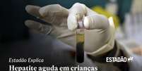 Hepatite infantil misteriosa: o que sabemos sobre a doença de origem desconhecida  Foto: cms / cms