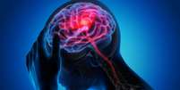 Entenda a epilepsia  Foto: Shutterstock / Saúde em Dia