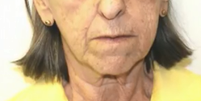 Sônia Maria da Costa, de 79 anos, foi vítima de um grupo especializado em roubar idosos ricos.  Foto: Reprodução/Globoplay/Fantástico