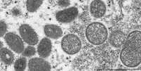 Vírus da varíola dos macacos: variante da África Ocidental é menos contagiosa e mais branda que a da África Central  Foto: DW / Deutsche Welle