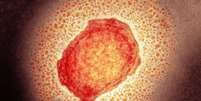 Partícula do vírus da varíola dos macacos; Brasil tem dois casos confirmados  Foto: Science Photo Library / BBC News Brasil