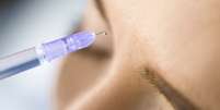 Inje&ccedil;&otilde;es de &aacute;cido hialur&ocirc;nico ajudam a preencher camadas a pele que se tornam menos espessas com o passar dos anos  Foto: Getty Images / BBC News Brasil
