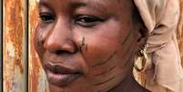 Mulher com cicatriz facial  Foto: BBC/ Nduka Orjinmo / BBC News Brasil