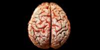 Mais de 30% dos pacientes de covid-19 apresentam problemas neurológicos (Imagem: Cookelma/Envato)  Foto: Canaltech