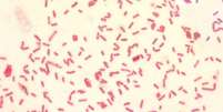 Sob uma ampliação de 1000X, imagem revela bactérias Yersinia pestis  Foto: Divulgação / CDC