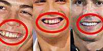 Muita gente n&atilde;o se lembra de como o futebolista transformou o sorriso ao longo dos anos. Foto: Reprodu&ccedil;&atilde;o