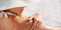 Cancer de pele verão  Foto: Shutterstock / Alto Astral