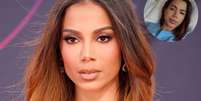Anitta se pronunciou sobre seu estado de sa&uacute;de.  Foto: Getty Images / Purepeople