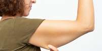 Renuvion: nova tecnologia pode tratar flacidez do braço  Foto: Shutterstock / Saúde em Dia