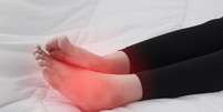 Inchaço nos pés e tornozelos? Saiba o que pode causar o edema -  Foto: Shuttestock / Saúde em Dia