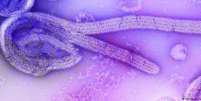 O vírus de Marburg causa febre hemorrágica  Foto: DW / Deutsche Welle