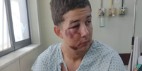 Jovem é agredido por pai e filho lutadores de MMA em bloco de carnaval  Foto: Reprodução/TV Globo