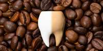 Dia do café: saiba como a bebida afeta seus dentes - Shutterstock  Foto: Alto Astral