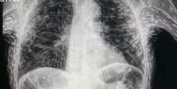 Registro de raio X chocou internautas  Foto: Reprodução