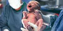 A expectativa de vida ao nascer estima quanto um bebê deve viver se as condições de um determinado lugar continuarem as mesmas  Foto: Getty Images / BBC News Brasil