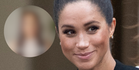 Meghan Markle fez cirurgia plástica recentemente?.  Foto: Getty Images, Reprodução/YouTube (TED Talk) / Purepeople