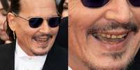 Dentes de Johnny Depp em Cannes chamam atenção da internet  Foto: Marc Piasecki/FilmMagic/gettyimages - Montagem: Redação Terra