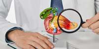 Câncer de pâncreas: saiba quais os primeiros sinais da doença -  Foto: Shutterstock / Saúde em Dia