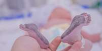 Teste do pezinho: por que o exame é indispensável após o nascimento? -  Foto: Shutterstock / Saúde em Dia
