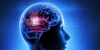 Elon Musk tem autorização para testar chip cerebral em humanos; há riscos? -  Foto: Shutterstock / Saúde em Dia