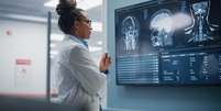 Imagem representa uma médica analisando imagens do cérebro humano  Foto: iStock