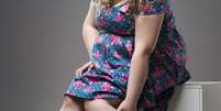 Lipedema - Shutterstock  Foto: Sport Life