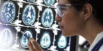 Médica olhando exames de cérebro  Foto: Getty Images / BBC News Brasil