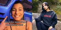 Natasha Santana contou com detalhes como passou pelas cirurgias de retirada de crânio  Foto: Reprodução/TikTok