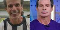 Resultado harmonização –  Foto: Reprodução Fofocalizando / SBT / Famosos e Celebridades