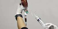 O ozônio medicinal costuma ser aplicado no sangue, na pele, nas articulações, nos músculos e no ânus, entre outros  Foto: Getty Images / BBC News Brasil