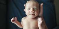 Bebê pequeno tem sua cabeça segurada por mão humana e olha diretamente para a câmera  Foto: Getty Images / BBC News Brasil