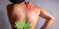 Cannabis medicinal é capaz de aliviar dores crônicas da fibromialgia -  Foto: Shutterstock / Saúde em Dia
