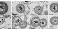 Bactéria misteriosa do oceano se multiplica por brotamento (Imagem: Zheng et al., 2023/eLife)  Foto: Canaltech