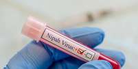 Imagem meramente ilustrativa de uma amostra de sangue infectado pelo Nipah vírus  Foto: Manjurul / iStock