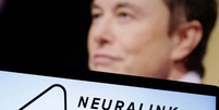 Embora o envolvimento de Musk aumente a visibilidade da Neuralink, a empresa enfrenta rivais que já acumulam experiência há quase duas décadas  Foto: Reuters / BBC News Brasil