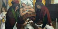 Obra provavelmente do século 16 retrata o suposto transplante de perna que os santos teriam realizado de forma milagrosa  Foto: Domínio Público / BBC News Brasil