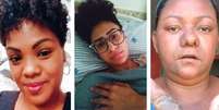 Kelli, Shely e Liliane relatam sofrer de efeitos colaterais pela inserção do Essure.  Foto: Arquivo pessoal / BBC News Brasil