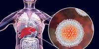 Infecção por hepatite C: Ilustração mostra o fígado e uma visão aproximada dos vírus da hepatite C Foto: Getty Images / BBC News Brasil