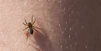 Imagem meramente ilustrativa de uma aranha no corpo de uma pessoa  Foto: gashgeron / iStock